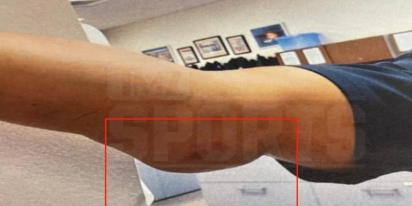 Leyu 体育网站-海斯袭警事件继续发酵 警方要求萧华对其进行严惩